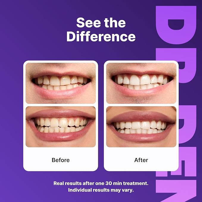 DR DENT Purple Teeth Whitening Strips